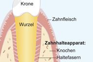 Zahnhalteapparat